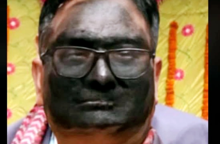 सीटीईभीटीका सहायक निर्देशकलाई कालोमोसो