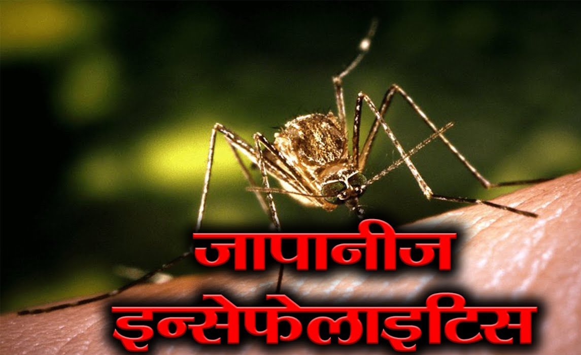 डेढ महिनाको अवधीमा नवलपरासीमा ईन्सेफ्लाईटिसबाट ३ जनाको मृत्यु
